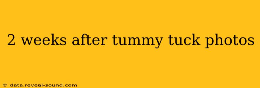 2 weeks after tummy tuck photos