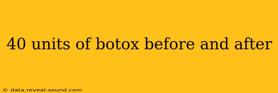 40 units of botox before and after