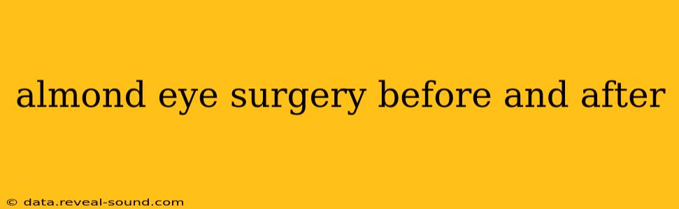 almond eye surgery before and after