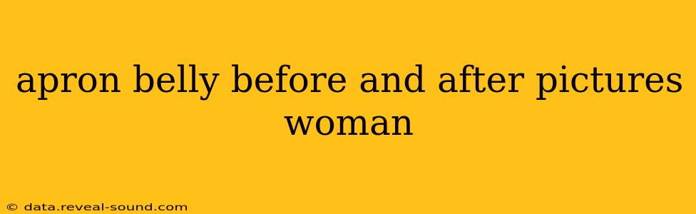 apron belly before and after pictures woman
