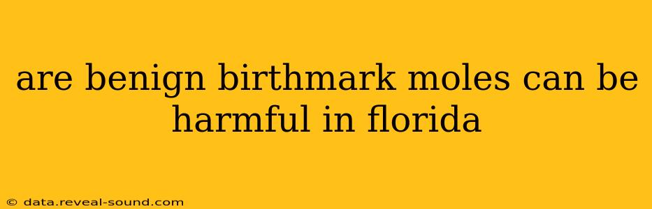 are benign birthmark moles can be harmful in florida