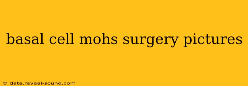 basal cell mohs surgery pictures
