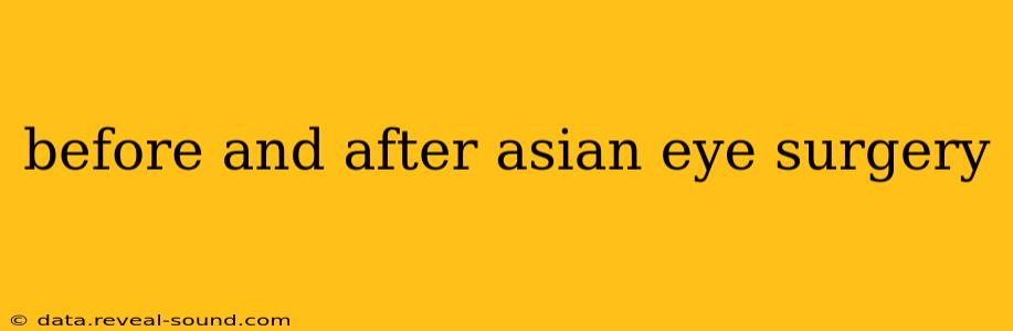 before and after asian eye surgery