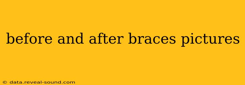 before and after braces pictures