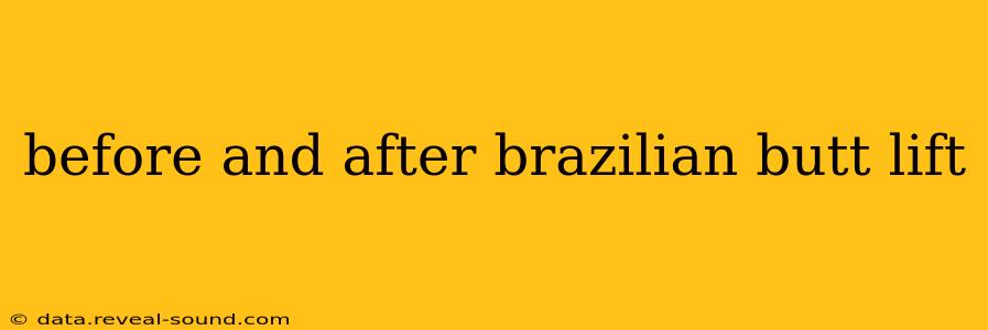 before and after brazilian butt lift