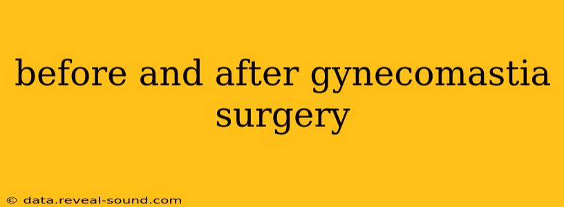 before and after gynecomastia surgery