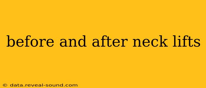 before and after neck lifts