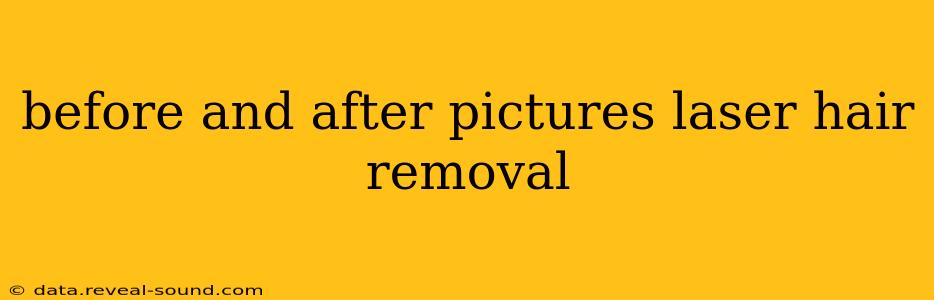 before and after pictures laser hair removal