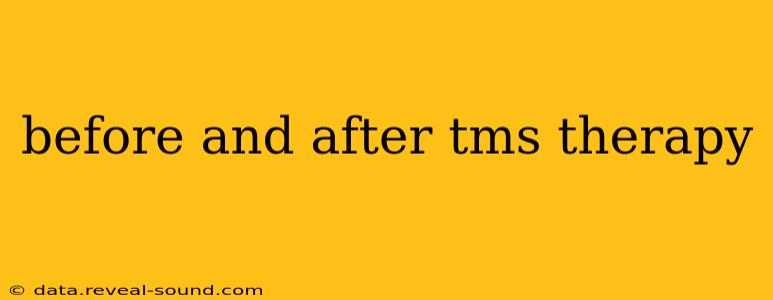 before and after tms therapy
