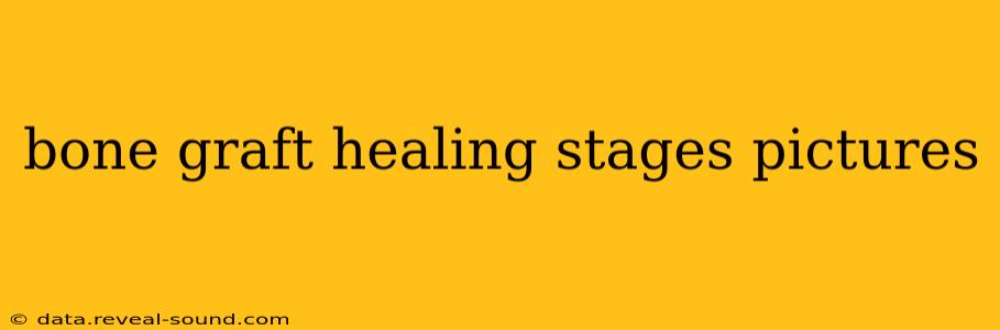 bone graft healing stages pictures