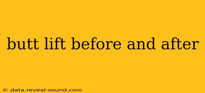 butt lift before and after