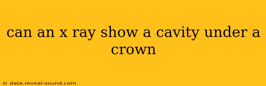 can an x ray show a cavity under a crown