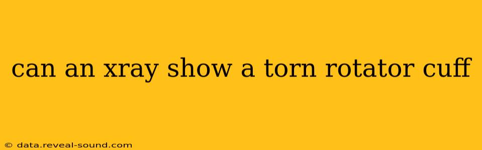 can an xray show a torn rotator cuff