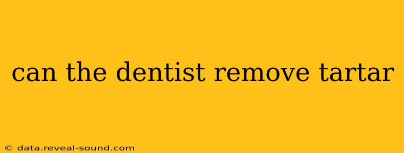 can the dentist remove tartar