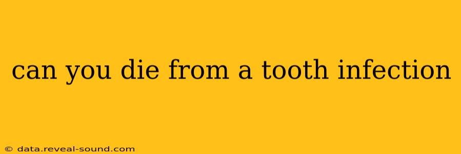 can you die from a tooth infection