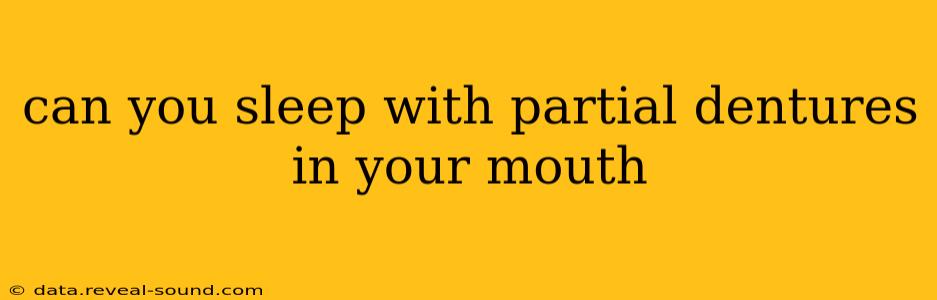 can you sleep with partial dentures in your mouth
