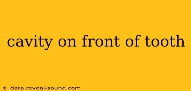 cavity on front of tooth