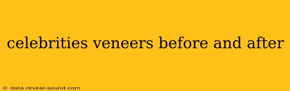 celebrities veneers before and after
