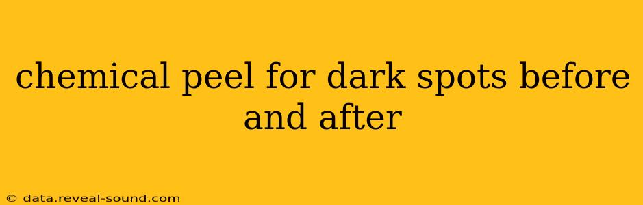 chemical peel for dark spots before and after