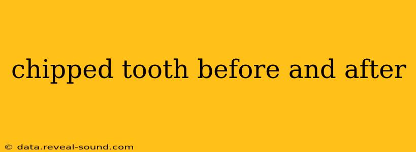 chipped tooth before and after