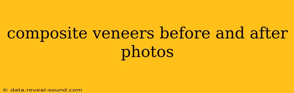 composite veneers before and after photos