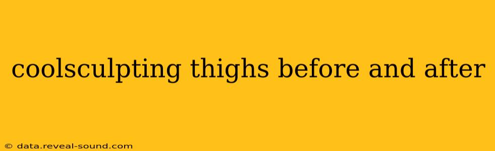 coolsculpting thighs before and after
