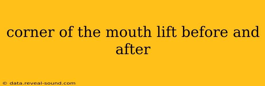 corner of the mouth lift before and after