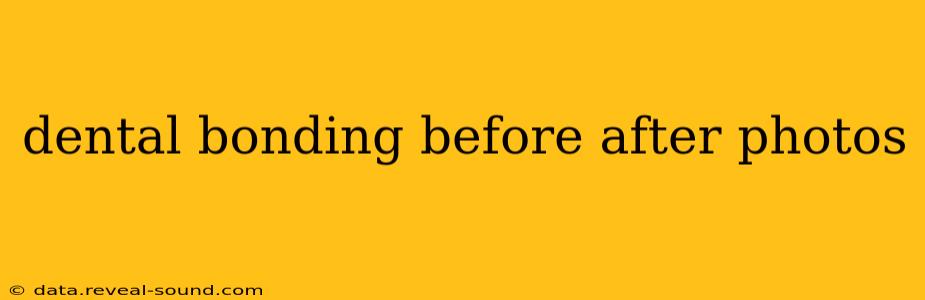 dental bonding before after photos