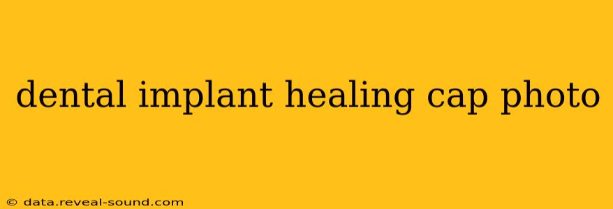 dental implant healing cap photo