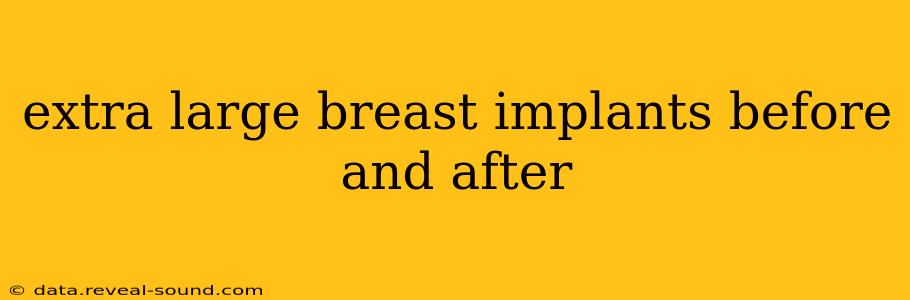 extra large breast implants before and after