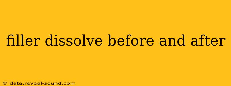 filler dissolve before and after
