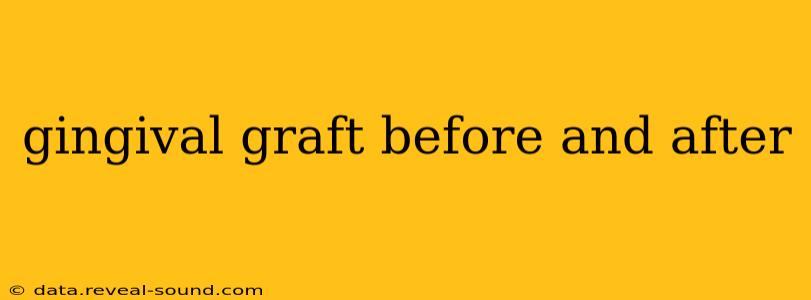 gingival graft before and after
