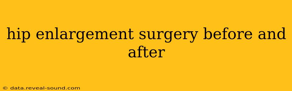 hip enlargement surgery before and after