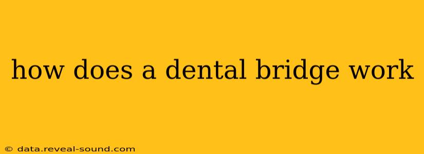 how does a dental bridge work