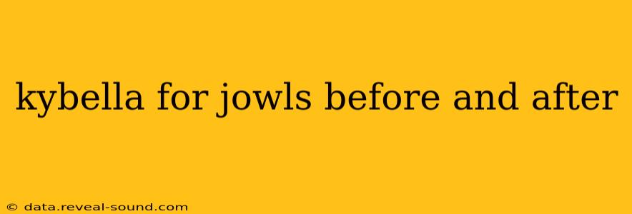 kybella for jowls before and after