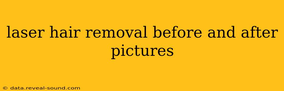 laser hair removal before and after pictures