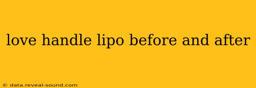 love handle lipo before and after