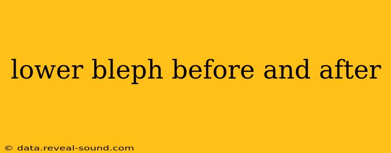 lower bleph before and after