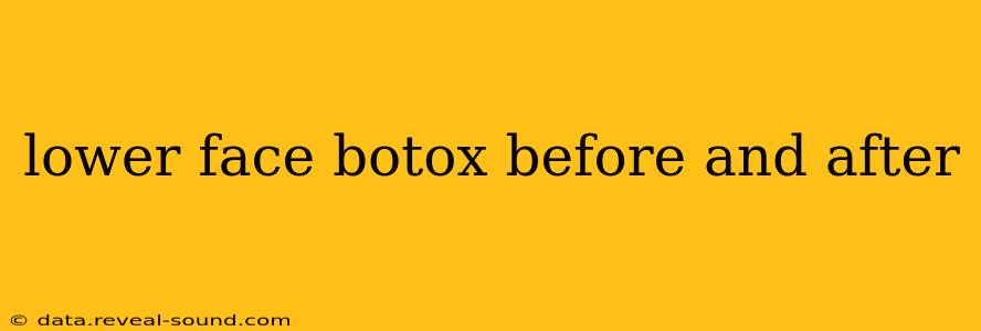 lower face botox before and after