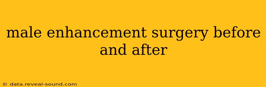 male enhancement surgery before and after