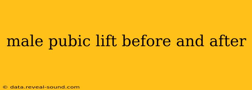male pubic lift before and after