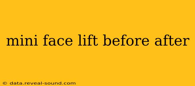 mini face lift before after