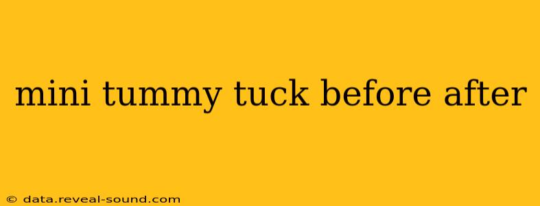 mini tummy tuck before after