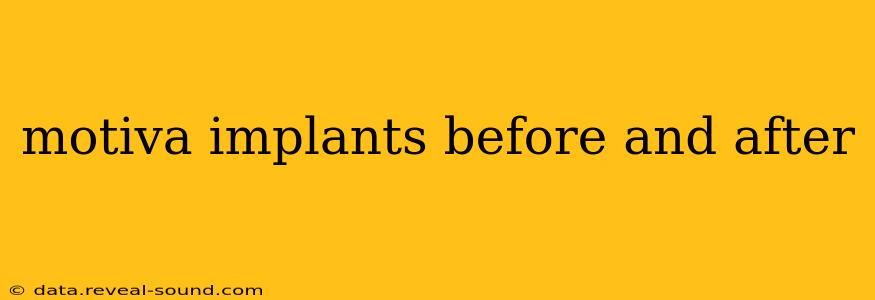 motiva implants before and after