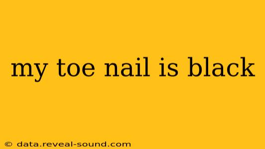 my toe nail is black