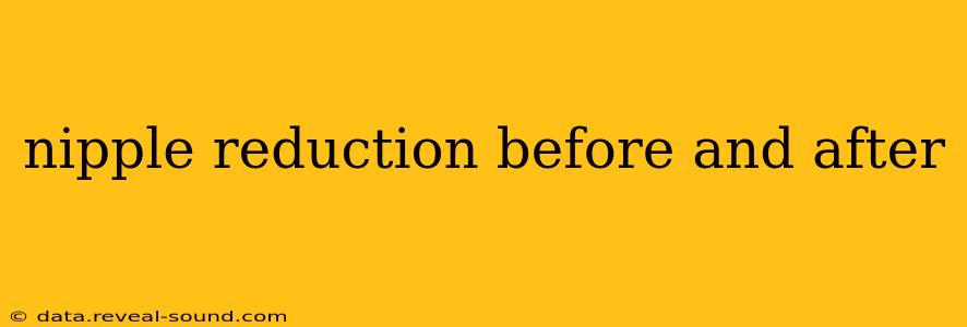 nipple reduction before and after