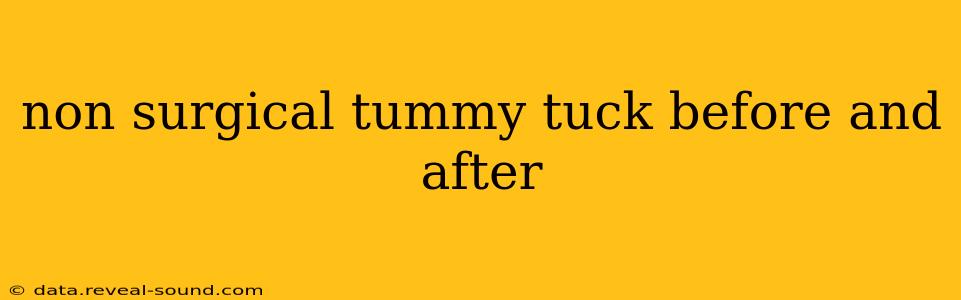non surgical tummy tuck before and after