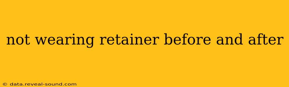 not wearing retainer before and after