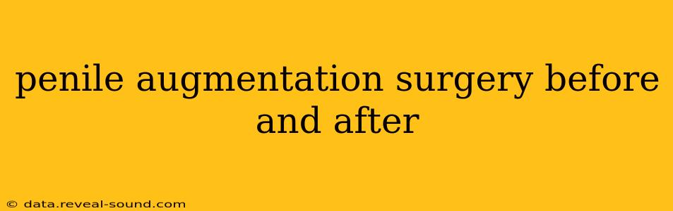 penile augmentation surgery before and after