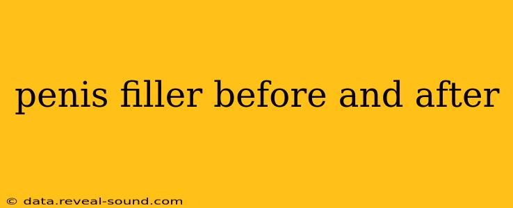 penis filler before and after penis filler before and after